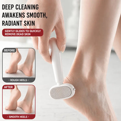 Smooth Heels Fast Dual-Sided Foot Callus Remover with Replaceable Stainless Steel Blade
