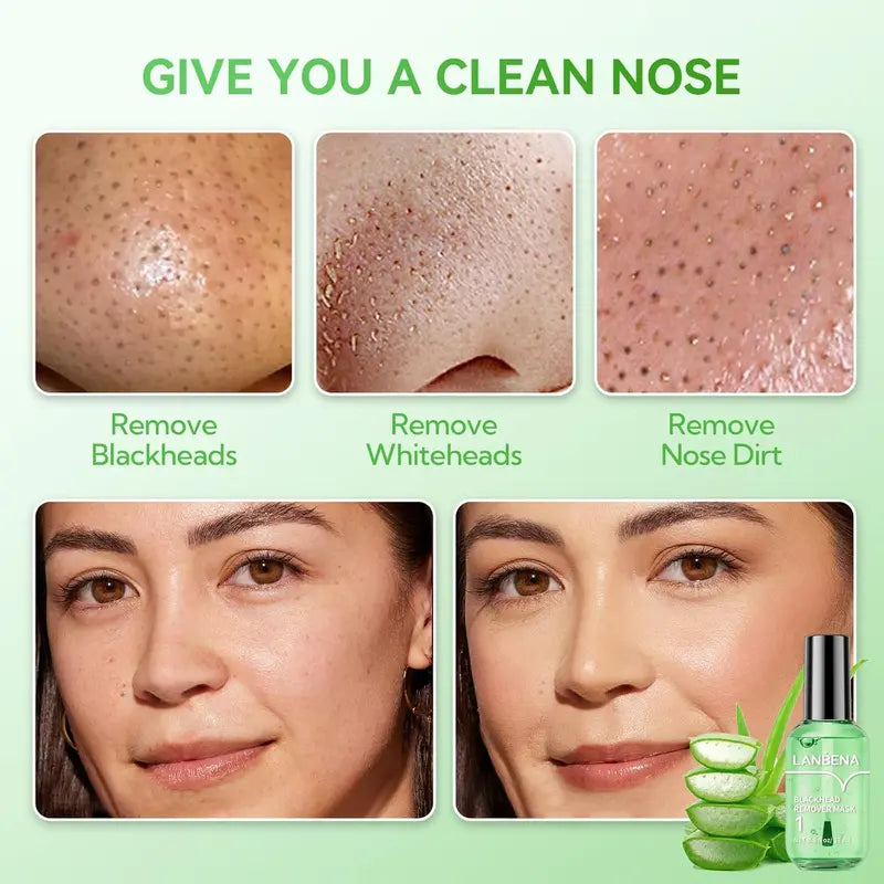 Green Tea Blackhead Remover Kit 100 Pore Strips + Pore Care Serum