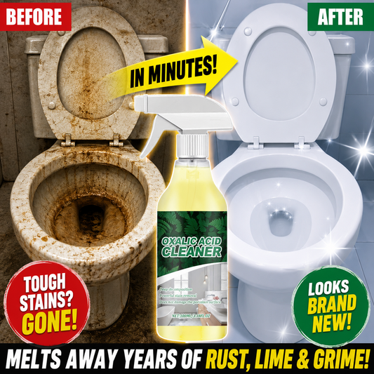Your Toilet Isn t Old It s Just FILTHY. Blast Away Years of Stains in Minutes