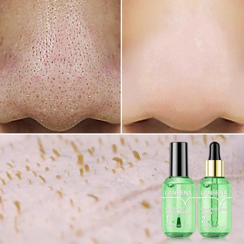 Green Tea Blackhead Remover Kit 100 Pore Strips + Pore Care Serum
