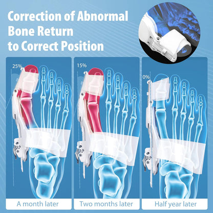 Adjustable Bunion Corrector Splint
