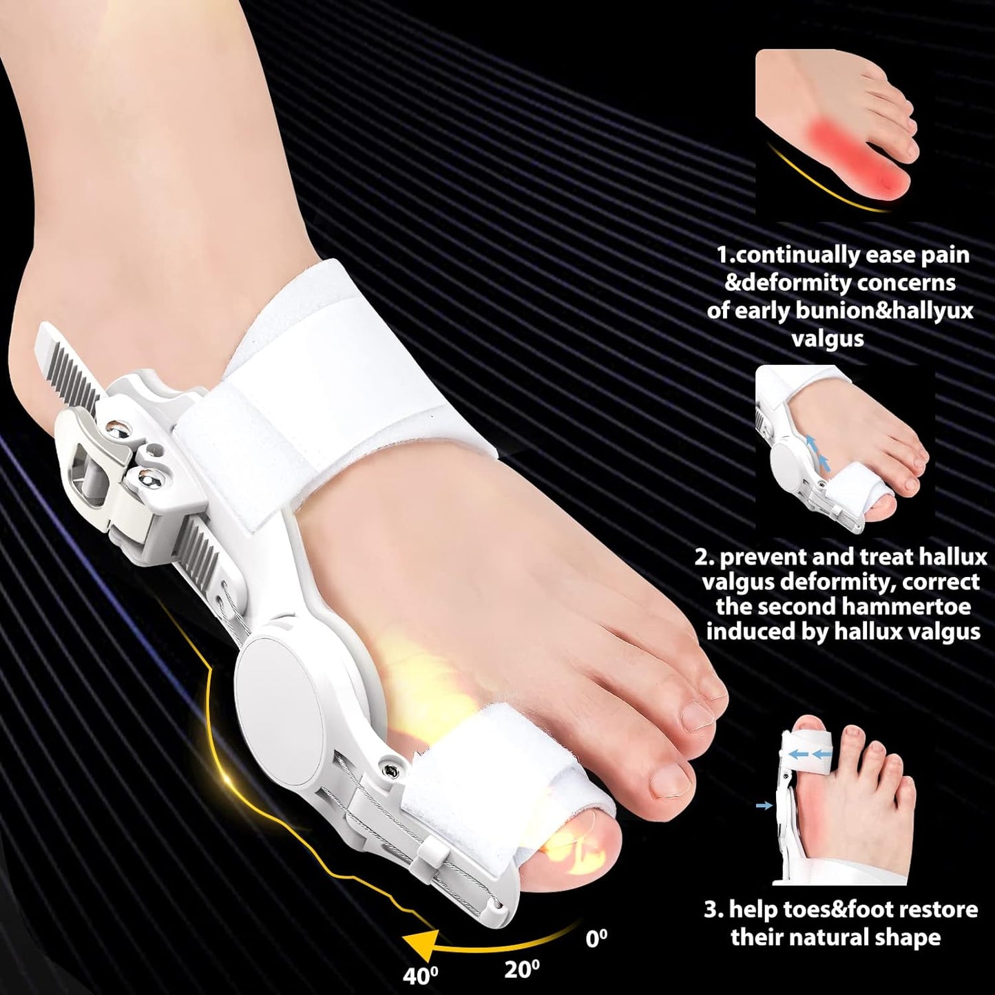 Adjustable Bunion Corrector Splint