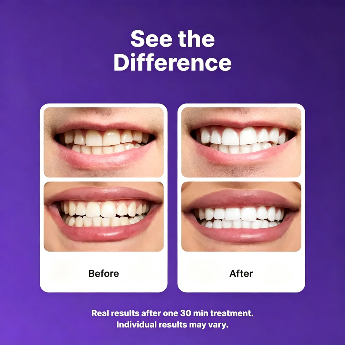 Purple Teeth Whitening Strips