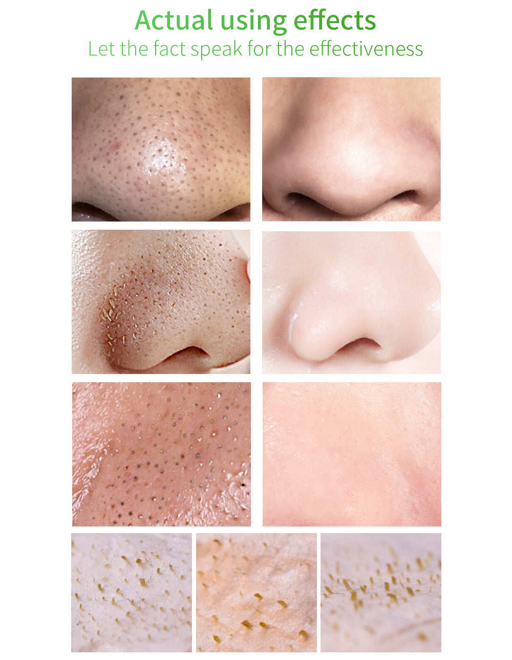 Green Tea Blackhead Remover Kit 100 Pore Strips + Pore Care Serum