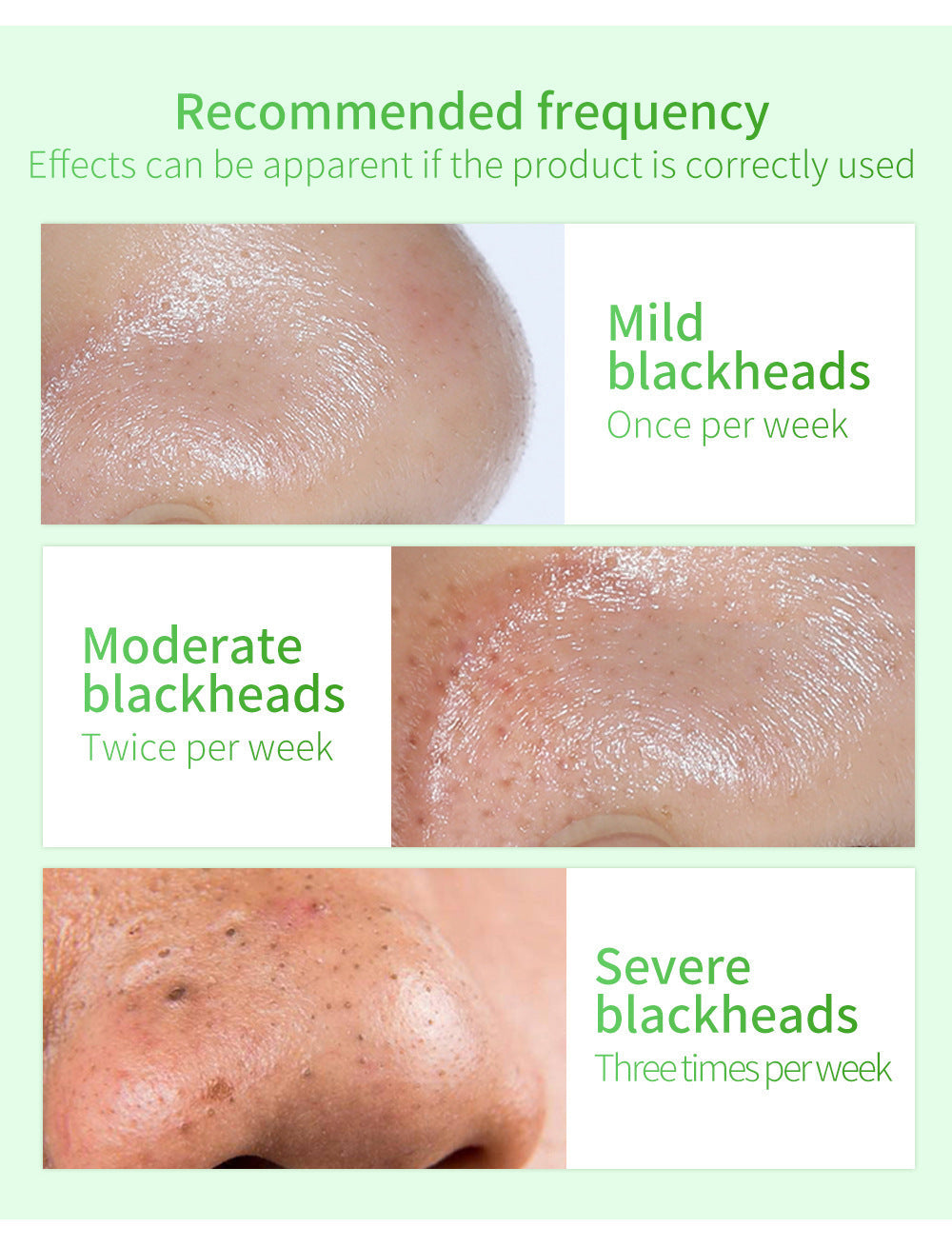 Green Tea Blackhead Remover Kit 100 Pore Strips + Pore Care Serum