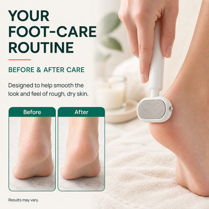 Dual-Sided Foot Callus Remover