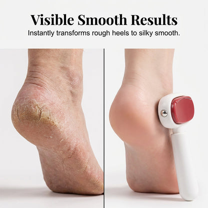 2-in-1 Foot Callus Remover Dual-Sided Foot Scraper with Replaceable Stainless Steel Blades